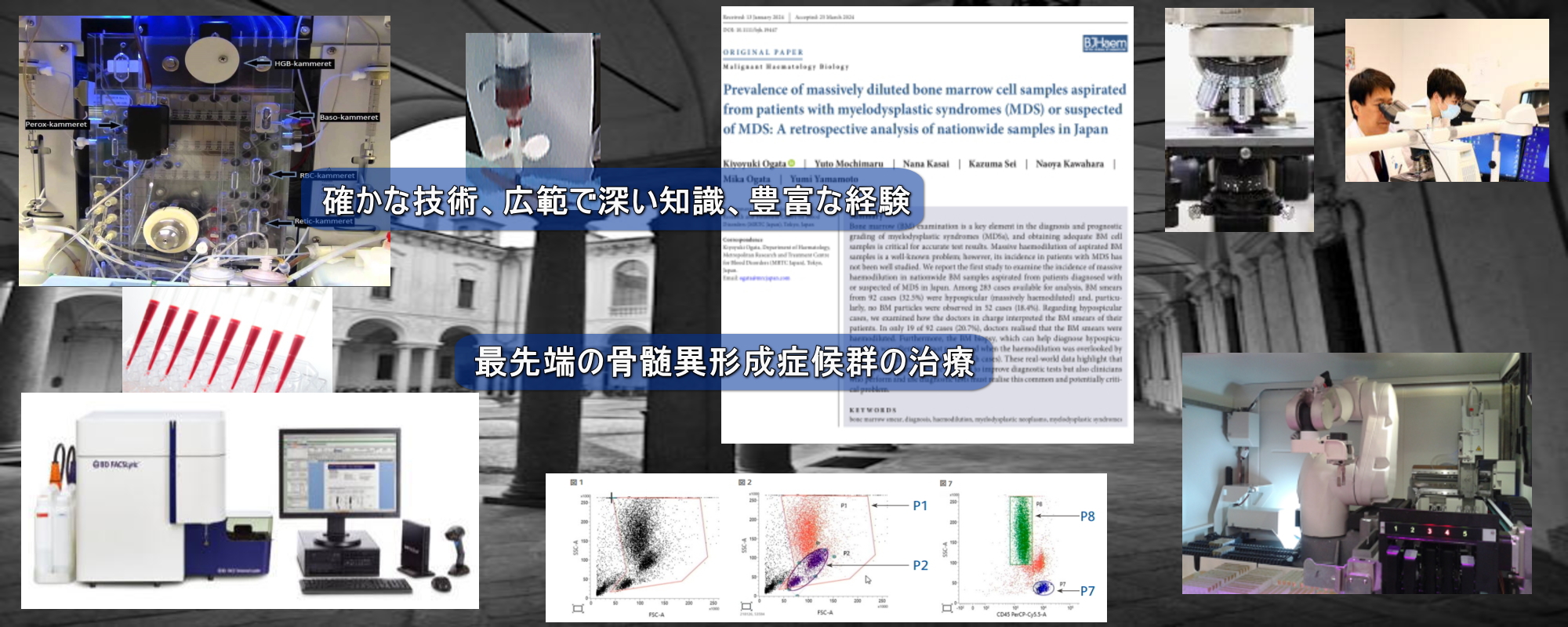 最先端の骨髄異形成症候群の治療